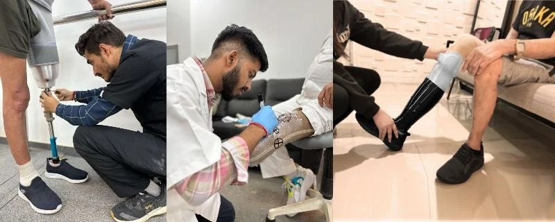 義足の製作、調整、装着の過程